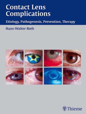 cover image of Contact Lens Complications